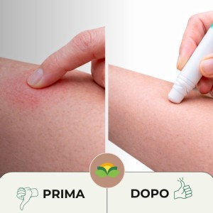 DOPOPUNTURA AMAZONIA PENNA CON AMMONIACA 12 ml