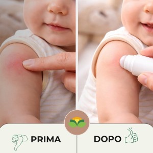 DOPOPUNTURA NATURALE BABY ROLL-ON 20 ml